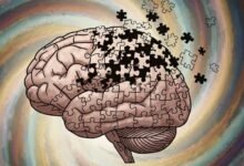 Illustration of brain showing memory loss