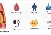 modifiable risk factors in atherosclerotic cardiovascular disease