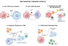 Tumor Associated Macrophages as Therapeutic Targets in NSCLC