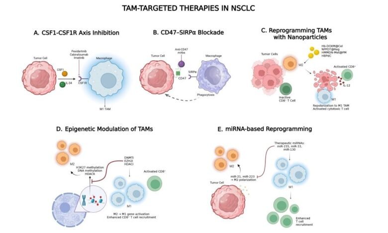 Tumor Associated Macrophages as Therapeutic Targets in NSCLC
